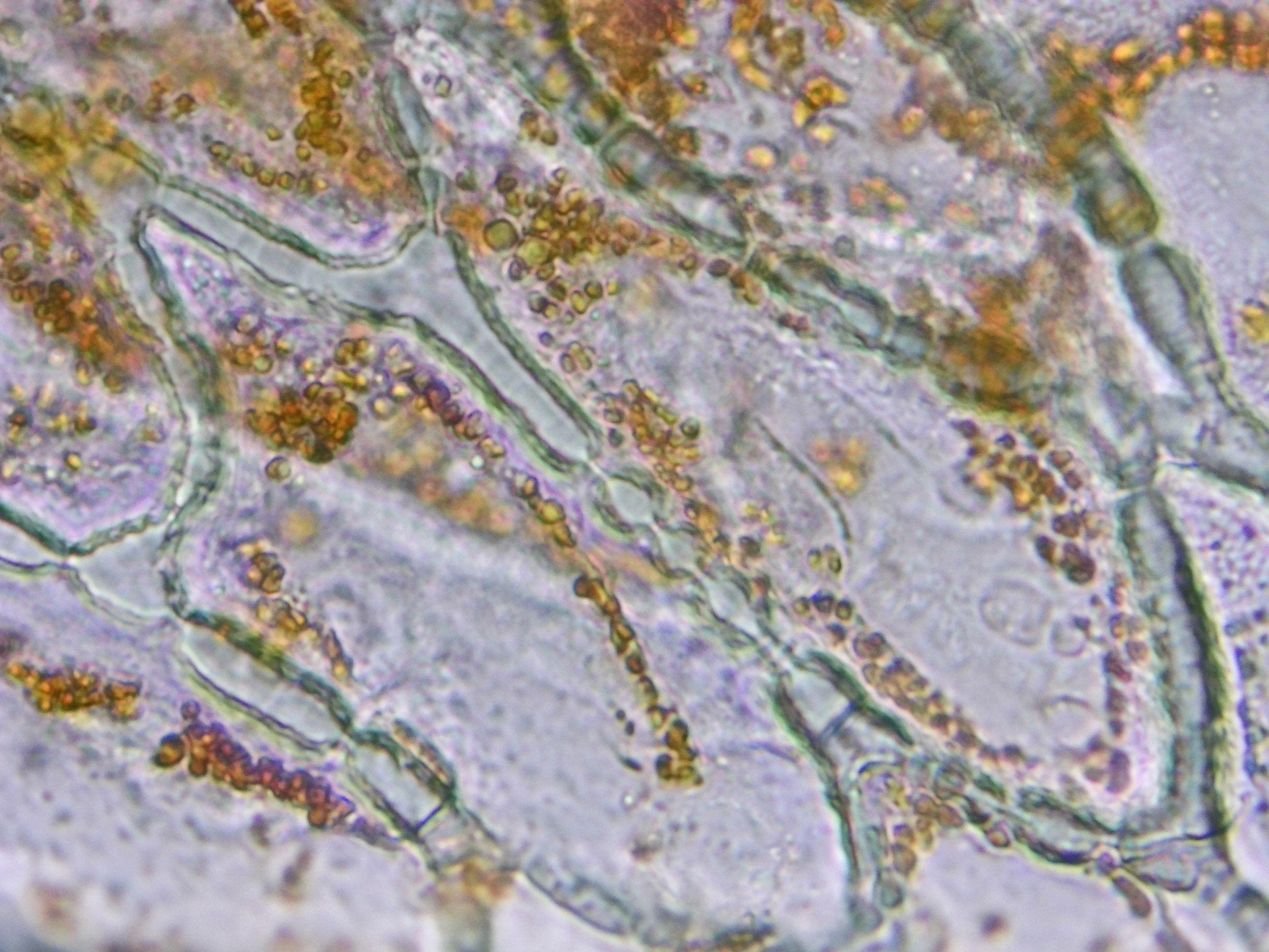 Epidermal sample under microscope