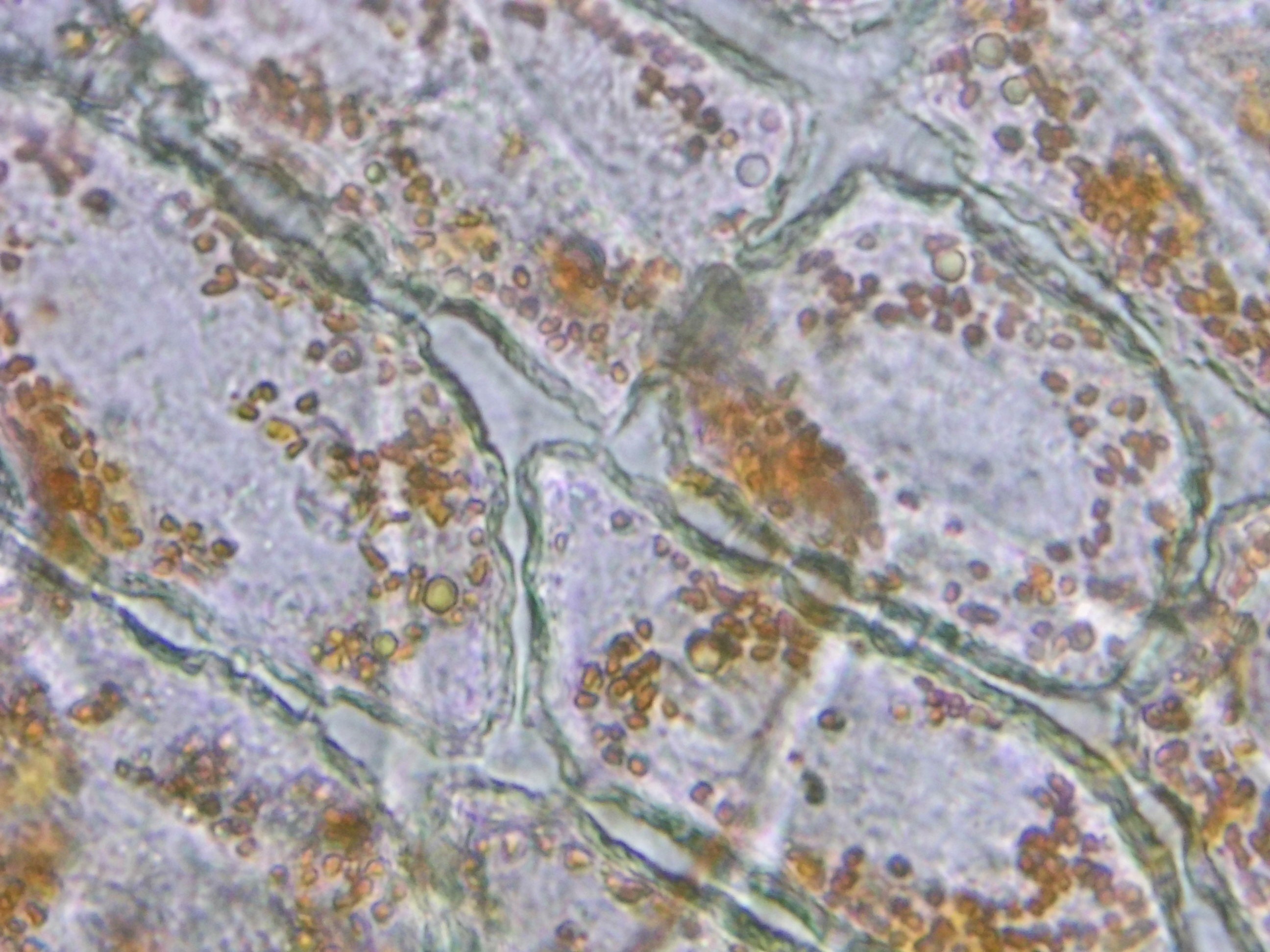 Epidermal sample under microscope